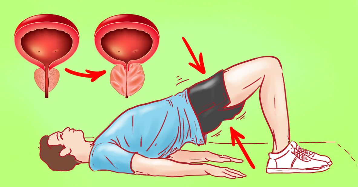 Exercices de gymnastique pour la prostatite